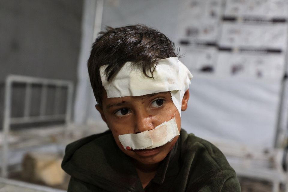 A wounded Palestinian child receives treatment following an Israeli strike on a house in Gaza City. Photo: Reuters